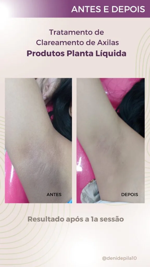 Resultado 3