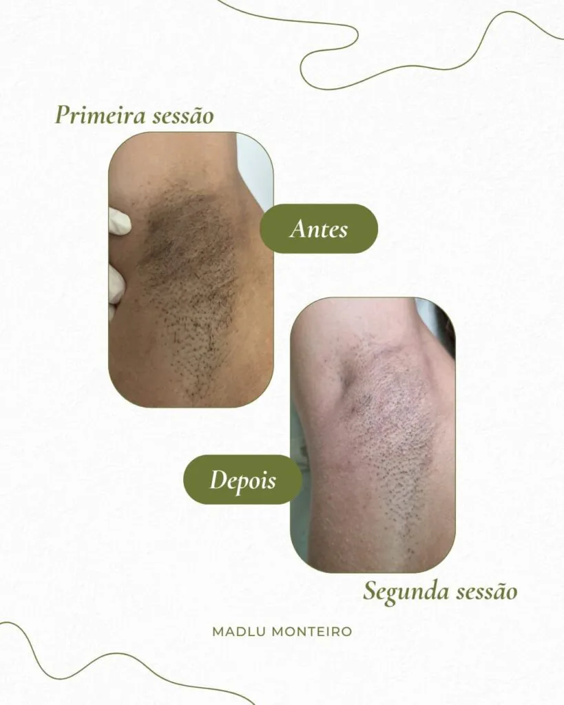 Resultado 6
