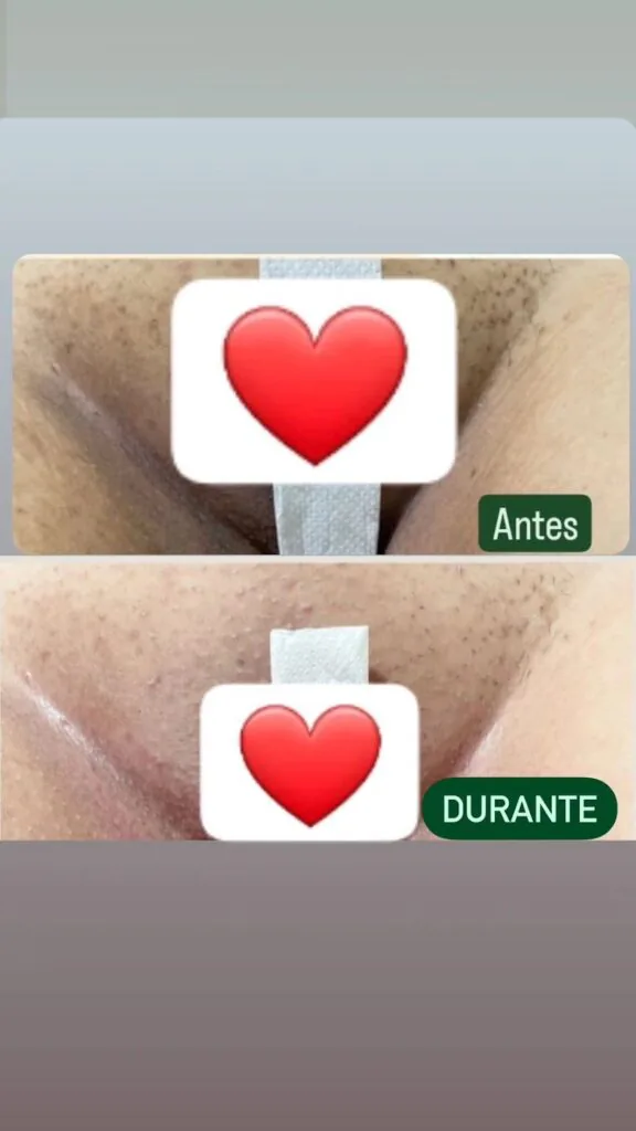 Resultado 10
