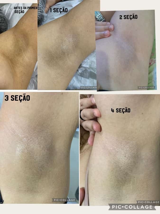 Resultado 18
